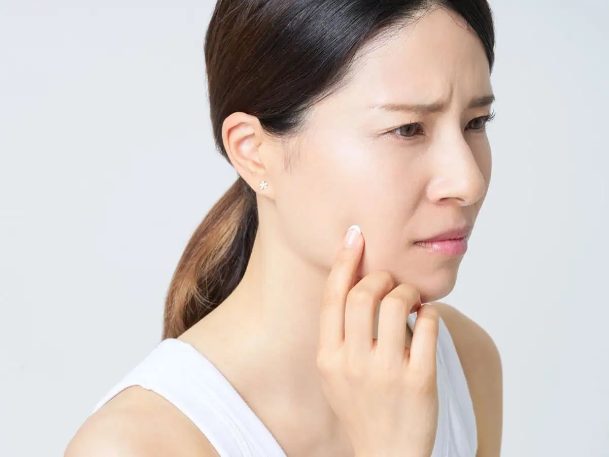 суха кожа менопауза